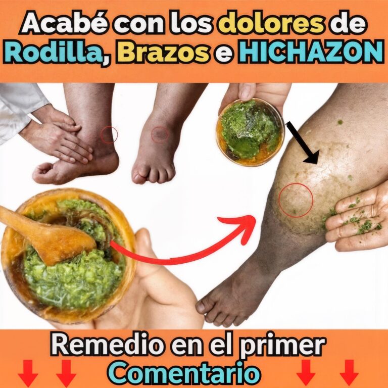  Alivio Natural para el Dolor en Rodillas, Espalda, Brazos y Calambres