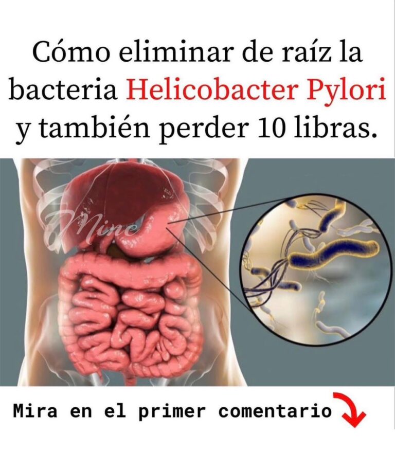 Elimina esta bacteria peligrosa de tu estómago y pierde peso sin esfuerzo