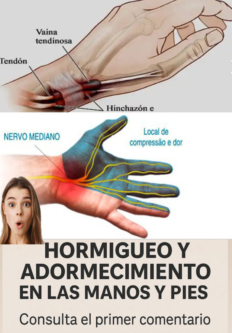 ¿Por qué se te duermen las manos? Señales que podrían estar indicando algo grave