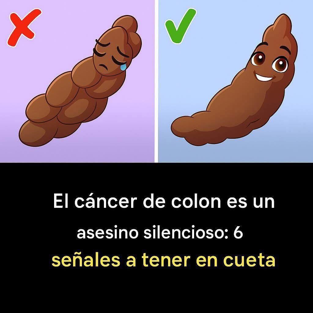 6 señales de cáncer de colon que no debes ignorar