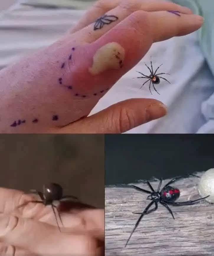¿Qué hacer si te muerde una araña viuda negra?