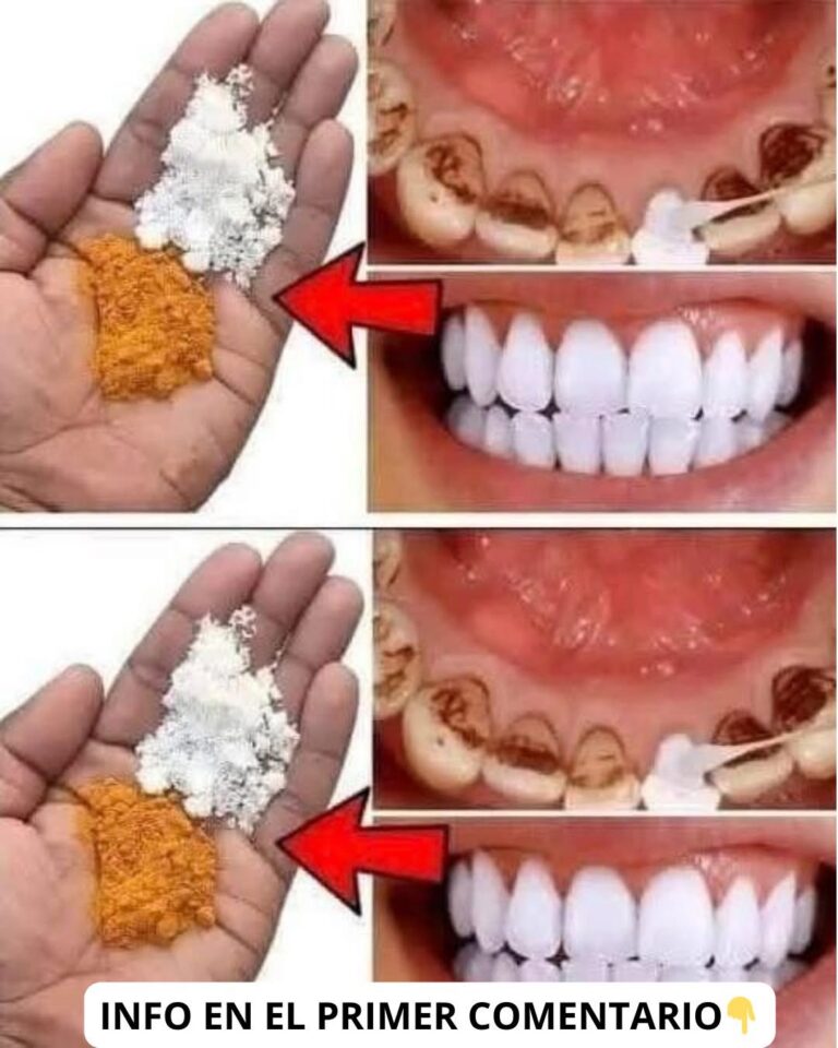 Los dentistas lo tienen oculto: ¿Blanqueamiento dental en sólo 2 minutos?