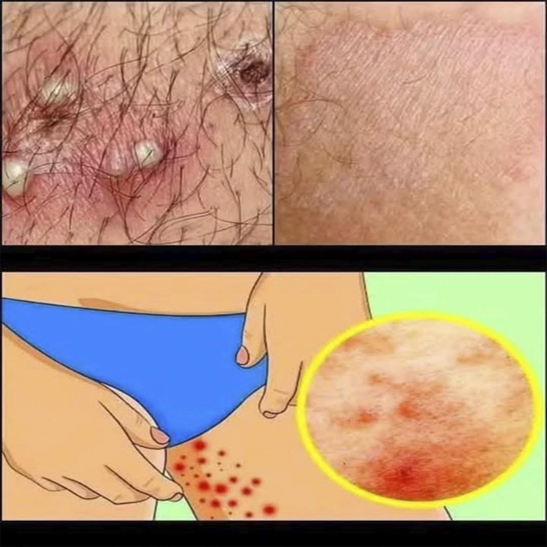 Deja de afeitarte con afeitadoras malas: tu piel lo agradecerá