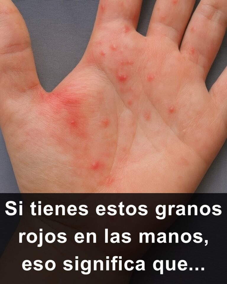 Si ves estos granos rojos en las manos, esto es lo que realmente significa