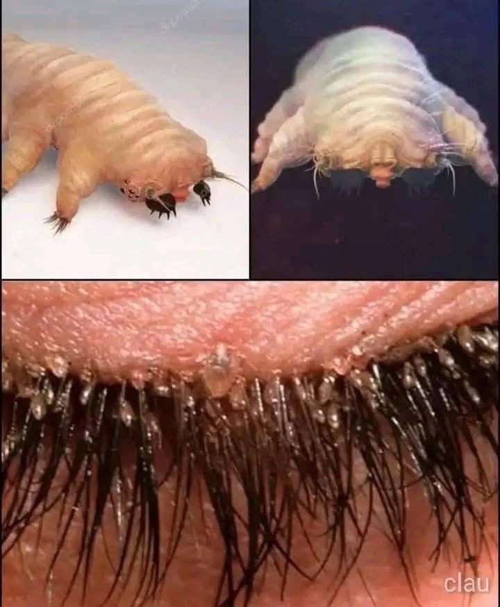 ¡Atención! Esta pequeña criatura vive en tu cuerpo y puede inflamar tus párpados