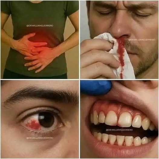 Cáncer de Estómago: Síntomas Claros que Debes Conocer