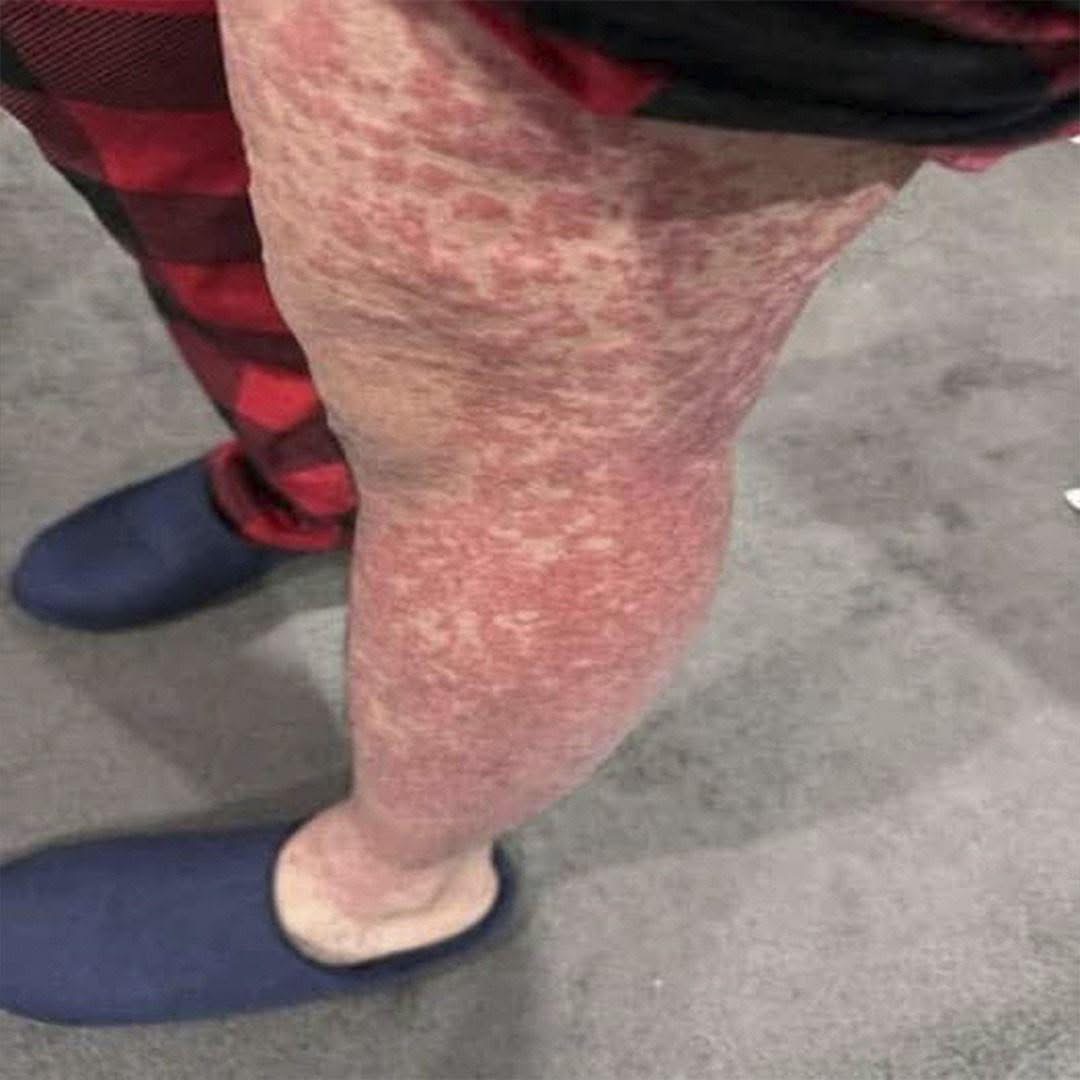 Lo que tu cuerpo podría estar intentando decirte