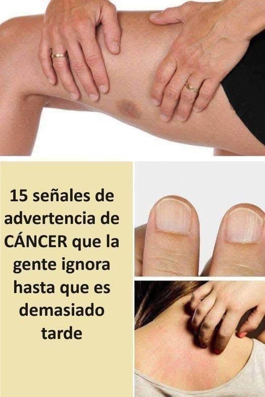 15 señales de cancer que tu cuerpo te da y tú la ignoras