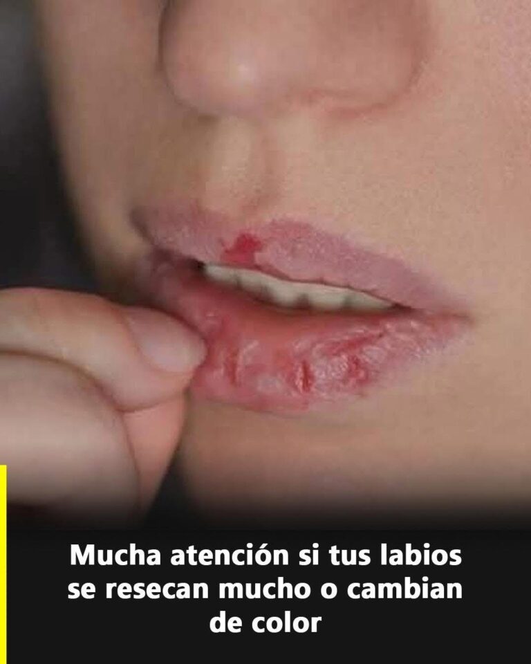 Si tu boca se reseca de esta forma, presta atención