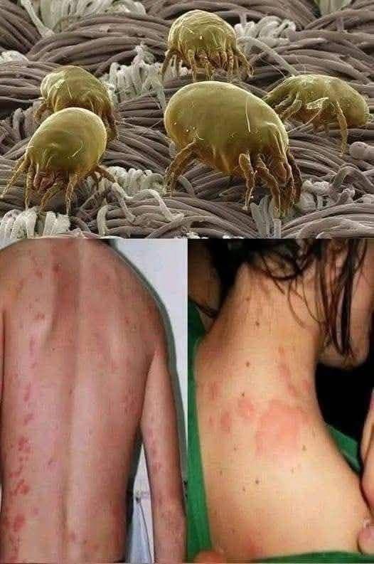 Si despierta con picazón y ardor esto es lo que está pasando