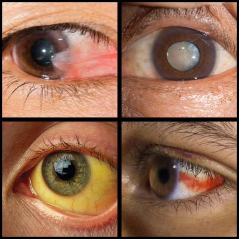 Cuando te sientas estos síntomas ve al médico urgentemente