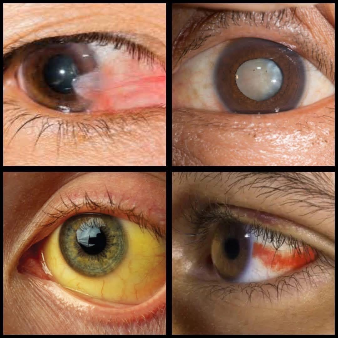 Cuando te sientas estos síntomas ve al médico urgentemente