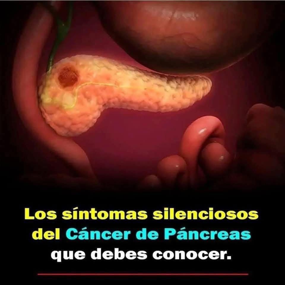 Esto son los síntomas más notables de cáncer de páncreas