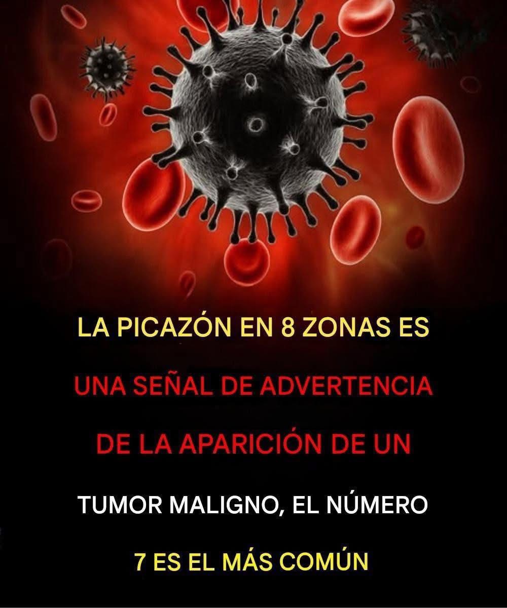 La picazón en 8 zonas que puede advertir un tumor maligno