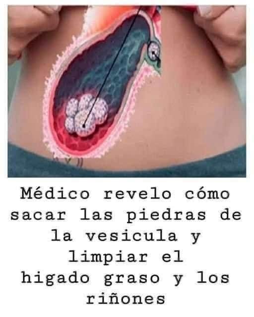 Cómo eliminar piedras de la vesícula y limpiar el hígado graso y los riñones