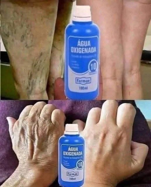 Agua oxigenada elimina arrugas y manchas del rostro