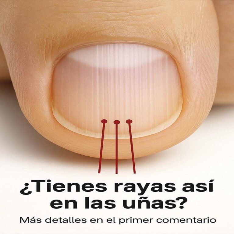Rayas en las uñas: lo que revelan sobre tu salud y cómo tratarlas