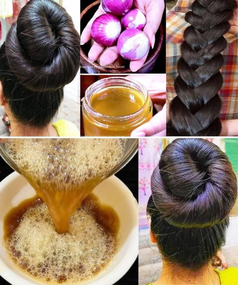 Cómo hacer aceite de cebolla para un crecimiento más rápido del cabello y detener la caída