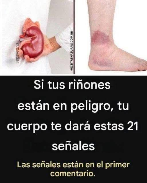 21 señales de que tus riñones están en peligro y tu cuerpo te las advierte