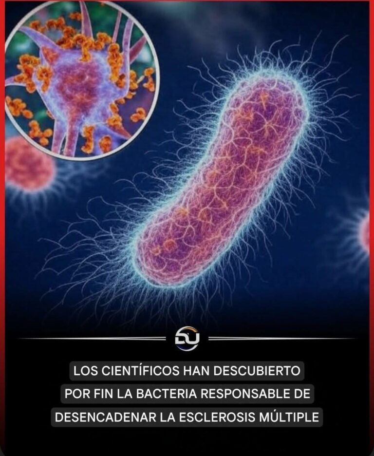 Bacteria, Virus y Esclerosis Múltiple: Lo Que La Ciencia Realmente Ha Descubierto