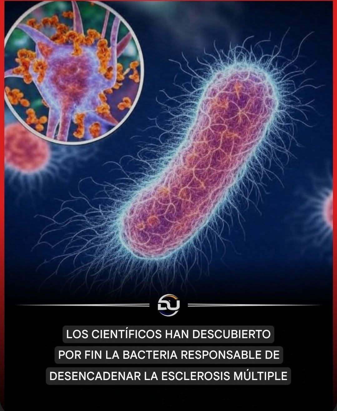 Bacteria, Virus y Esclerosis Múltiple: Lo Que La Ciencia Realmente Ha Descubierto