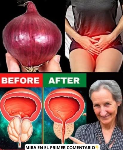 Hará que tu vejiga y próstata luzcan como nuevas