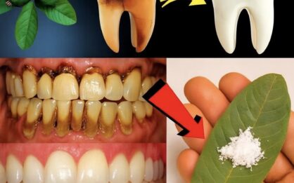 3 Mejores Formas de Tratar la Caries Dental con Hojas de Guayaba img