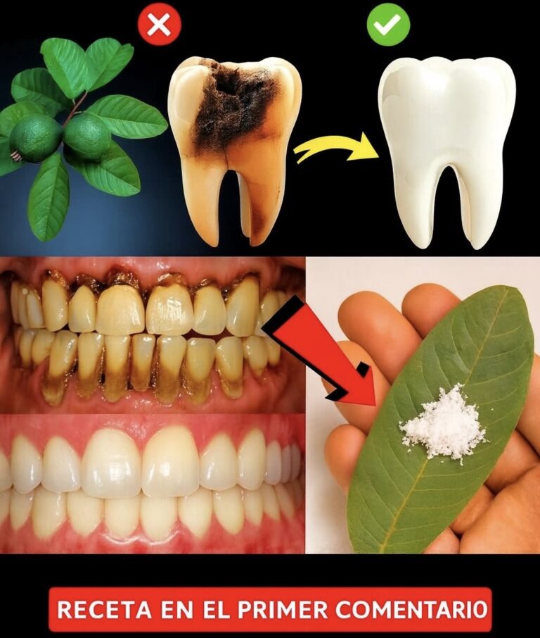 3 Mejores Formas de Tratar la Caries Dental con Hojas de Guayaba
