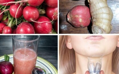 Rábanos, Jengibre y Miel: Remedios Naturales para la Tiroides y la Vesícula img