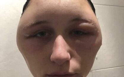 Cuidado al usar tintes para el cabello: pueden provocar efectos secundarios img