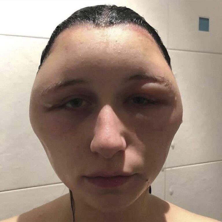 Cuidado al usar tintes para el cabello: pueden provocar efectos secundarios