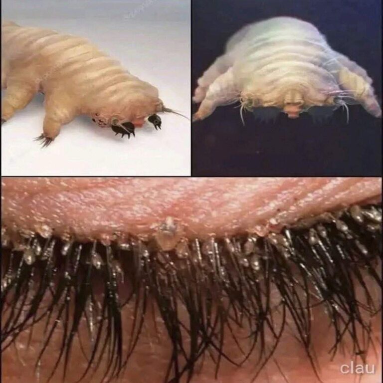 Los ácaros Demodex: la pequeña criatura que vive en tu cuerpo y puede causar problemas