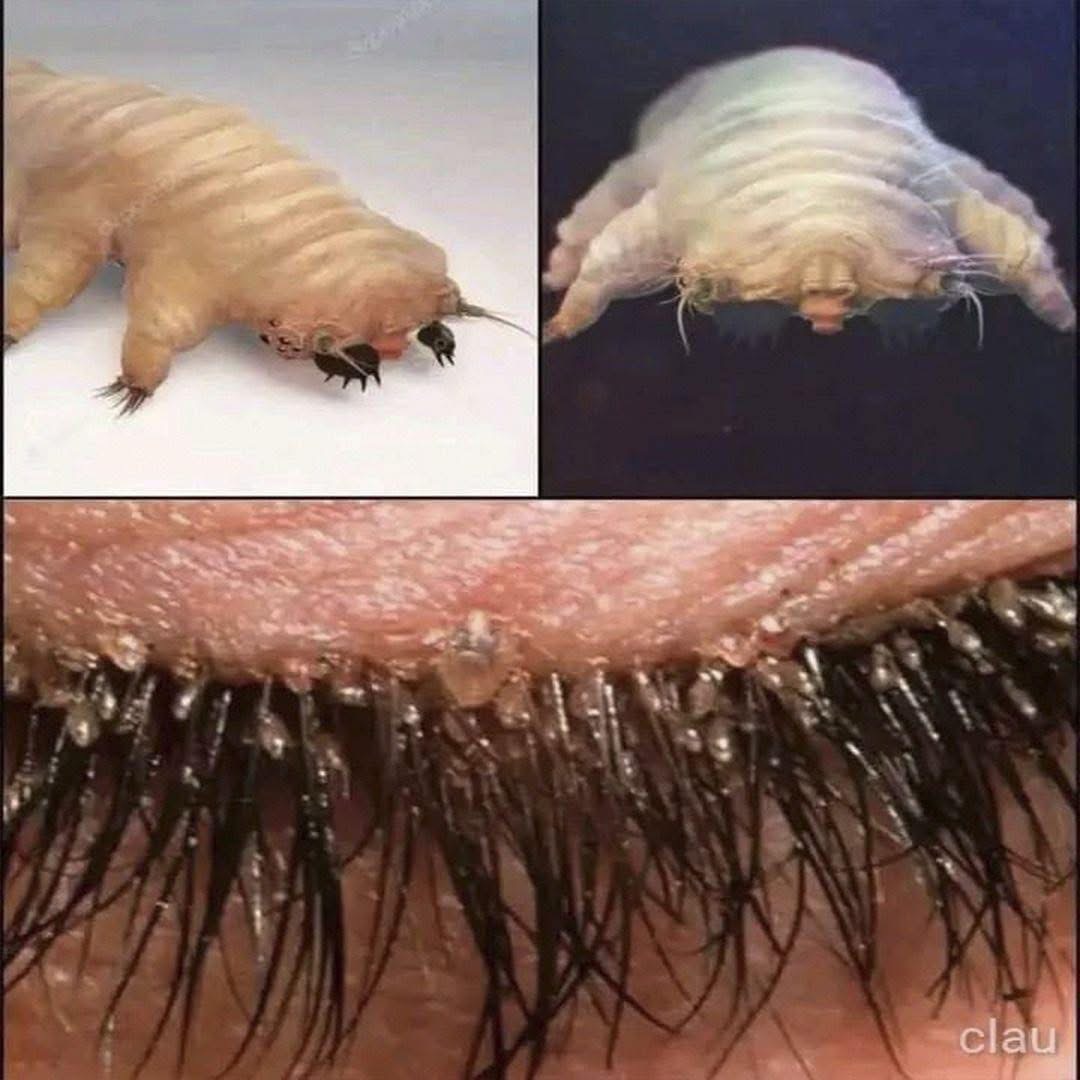 Los ácaros Demodex: la pequeña criatura que vive en tu cuerpo y puede causar problemas