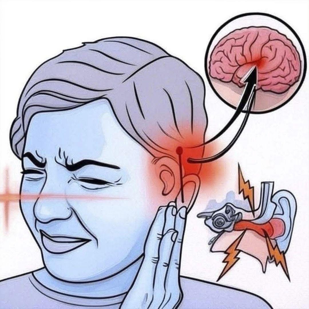 Si oyes zumbido en tu oído, esta es una señal de la que podrías sufrir