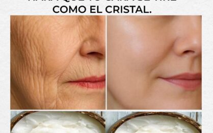 Prepara la crema de bicarbonato, ponla antes de dormir y adiós a las arrugas img