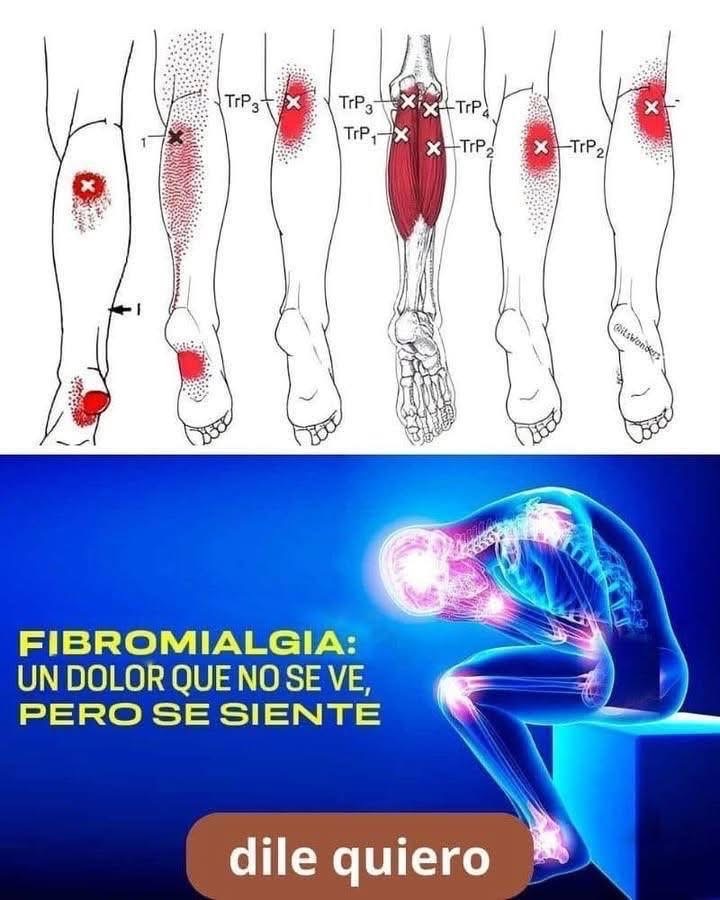 Fibromialgia: la enfermedad de las emociones no expresadas