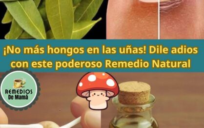 Cómo Eliminar Hongos en las Uñas de Forma Natural img
