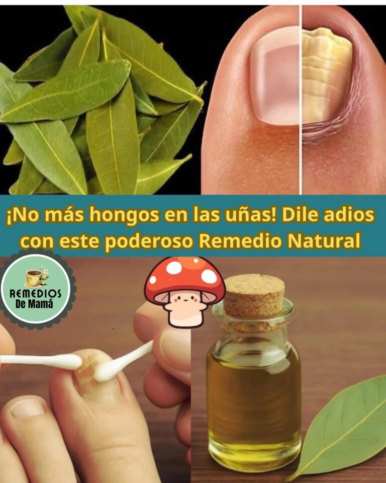 Cómo Eliminar Hongos en las Uñas de Forma Natural