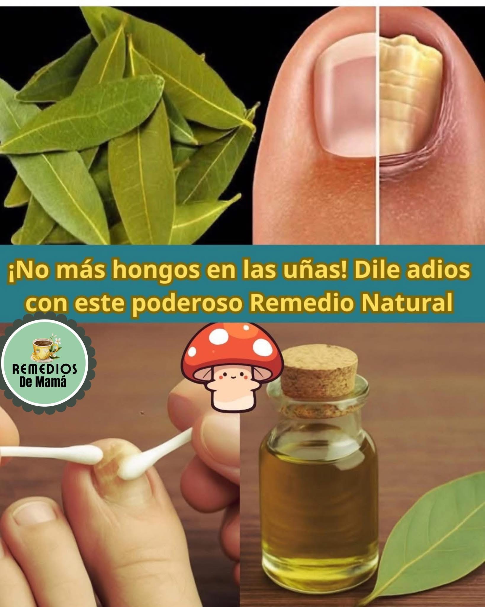 Cómo Eliminar Hongos en las Uñas de Forma Natural