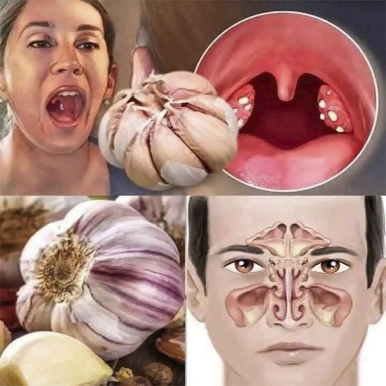 El Poder del Ajo: El Remedio Natural que Fortalece tu Salud