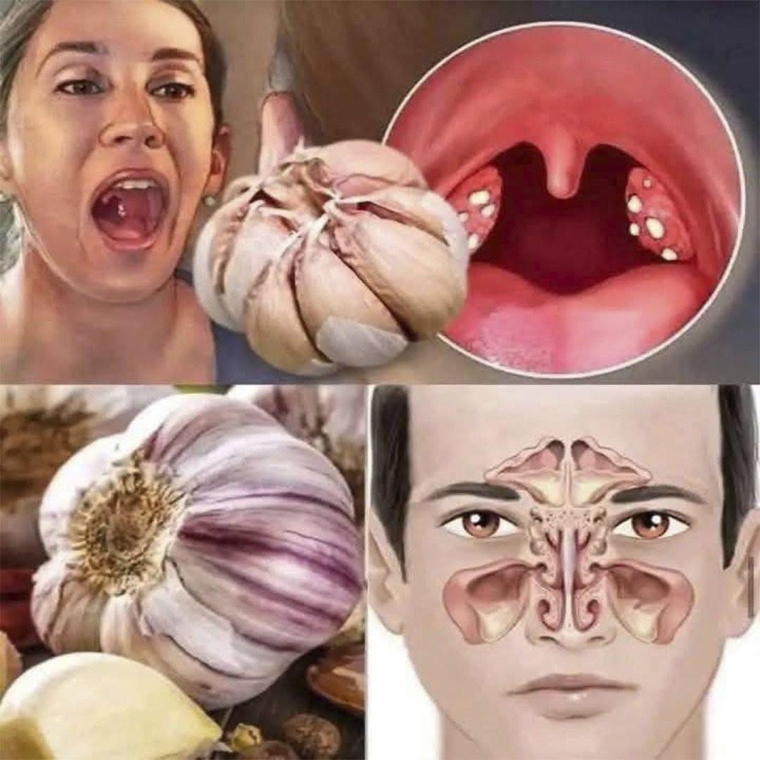 El Poder del Ajo: El Remedio Natural que Fortalece tu Salud