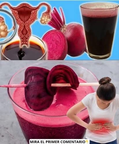 Quistes, miomas y fibromas: información completa y segura