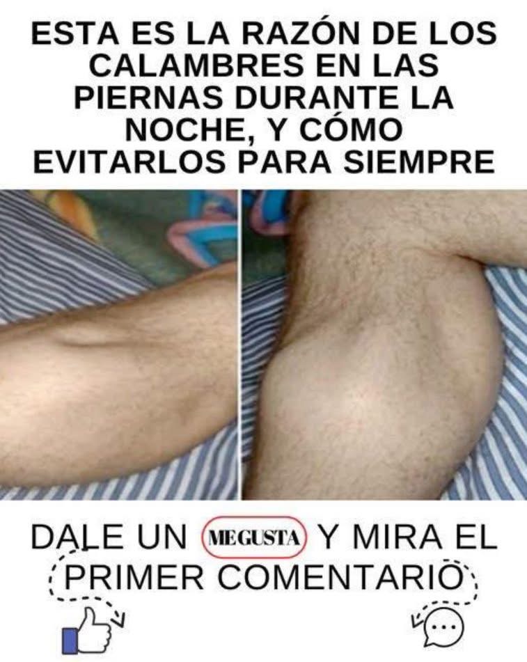 Calambres en las piernas y las manos: causas, prevención y tratamiento