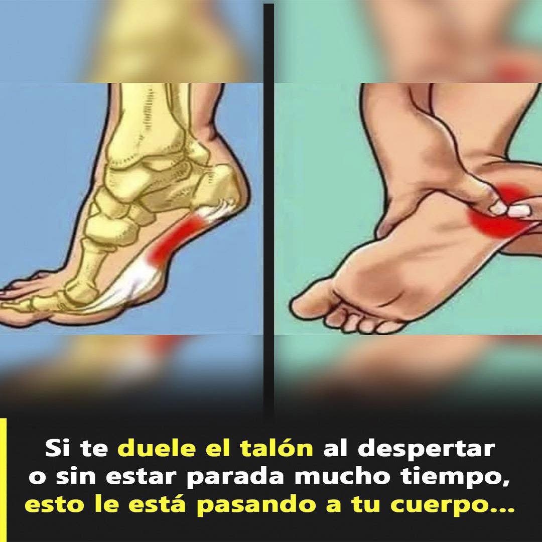 Si te duele el talón al despertar o sin estar parada mucho tiempo, esto le está pasando a tu cuerpo