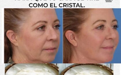 Crema de bicarbonato: adiós a las arrugas y manchas de forma natural img