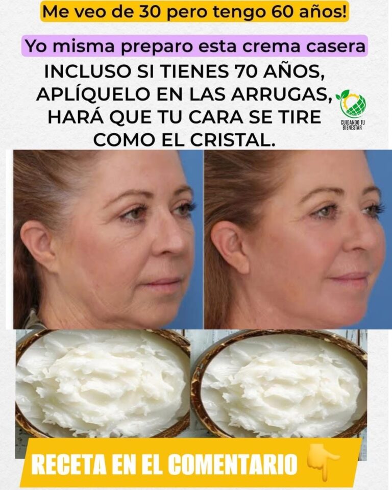 Crema de bicarbonato: adiós a las arrugas y manchas de forma natural