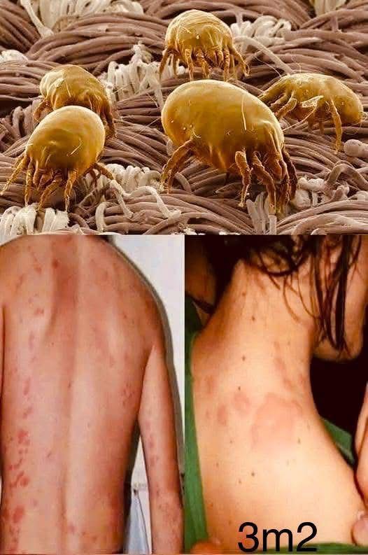 Cama llena de ácaros: aprende a erradicarlos de tu habitación