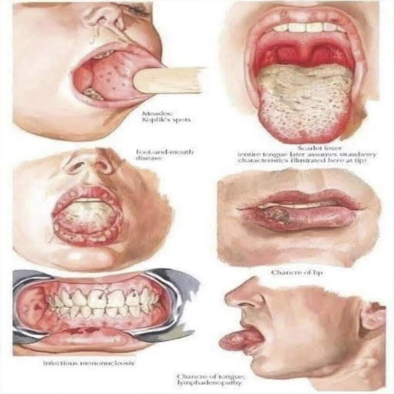 Signos en la boca: lo que tu salud quiere decirte