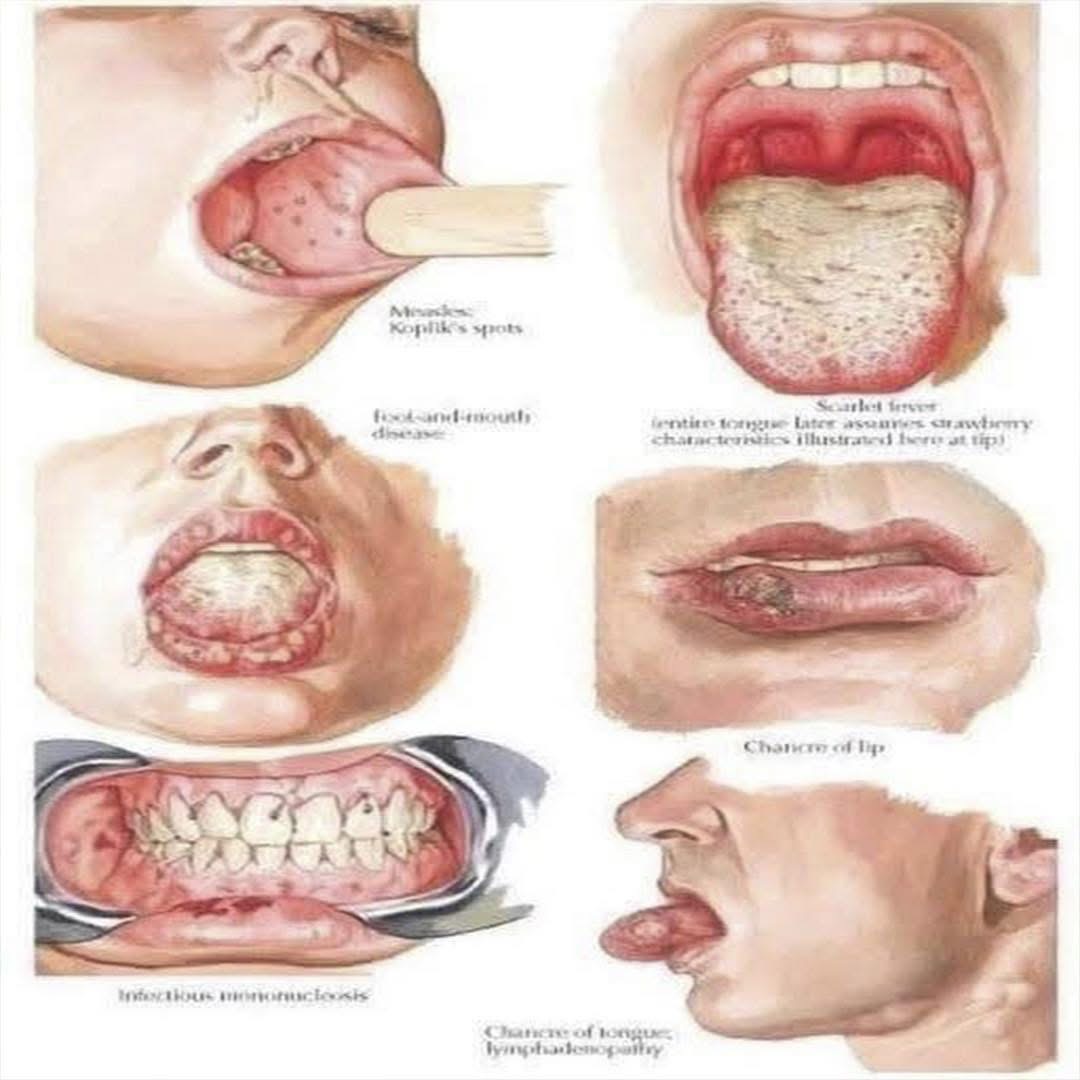 Signos en la boca: lo que tu salud quiere decirte