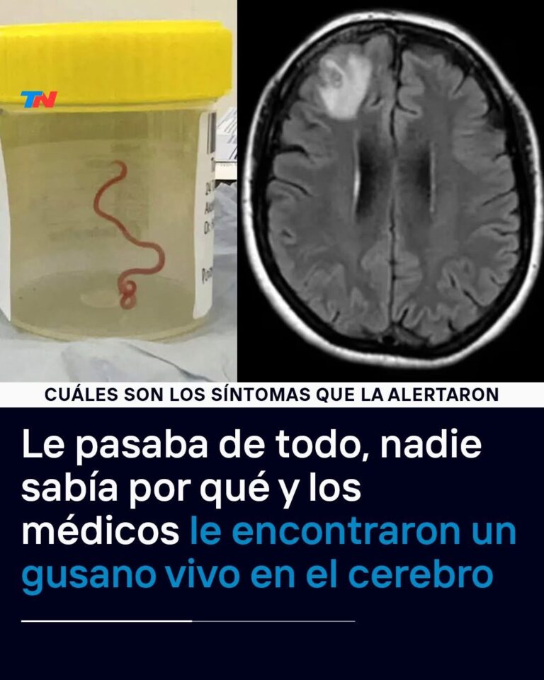 Le pasaba de todo, nadie sabía por qué y los médicos le encontraron un gusano vivo en el cerebro